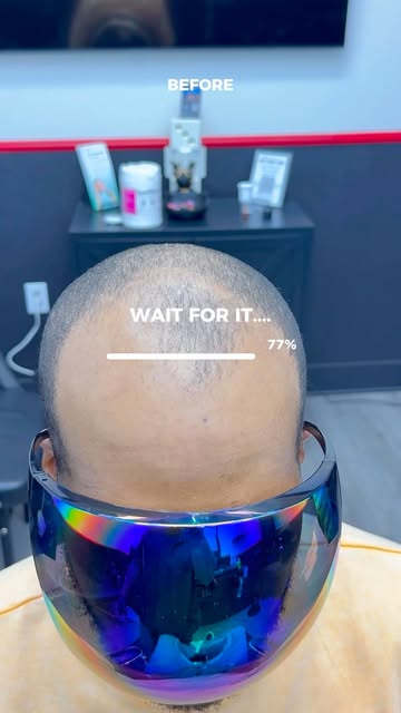 WHAT IF I TOLD YOU IT ONLY TAKES ONE SESSION TO GET YOUR CONFIDENCE BACK? 👀🌟 #vegasbarber #scalpmi