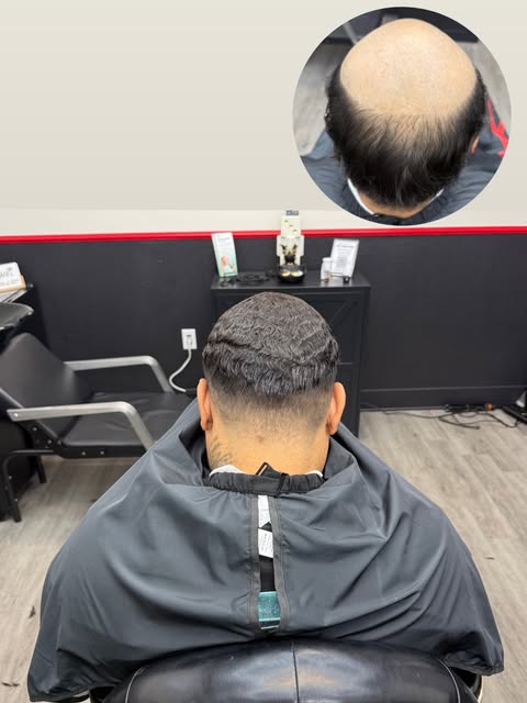 FIRST HAIR UNIT! Stop playing with HIM! 🔥🔥🔥🔥 

#hairunit #vegasbarber #hairtattoo #hairlosstreat