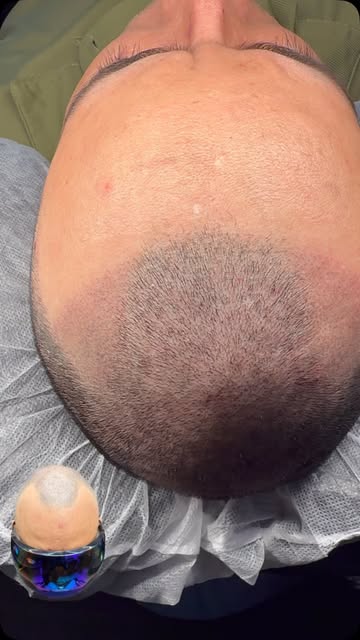 A sharp hairline isn’t for everyone.

Your hairline should fit YOU — your age, face shape, style, an