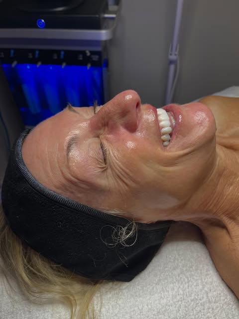 The skin & the smile 🫶🏻

Hydrafacial + NassifMD Hydraglucan™ Intense Hydration Booster
