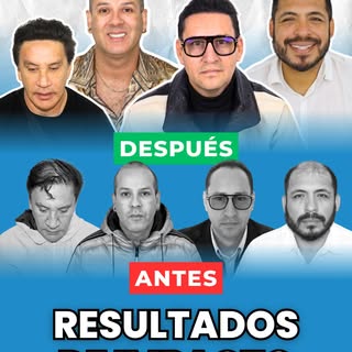 CAMBIOS SORPRENDENTES 🤩 Estos son los resultados increíbles que solo se logran con un buen trasplan