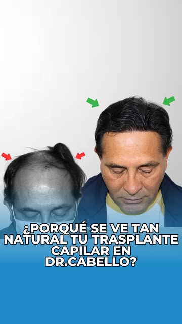 La naturalidad es nuestra especialidad! 😎✨
Separa tu cita ahora a nuestro WhatsApp +51 992164112 📲