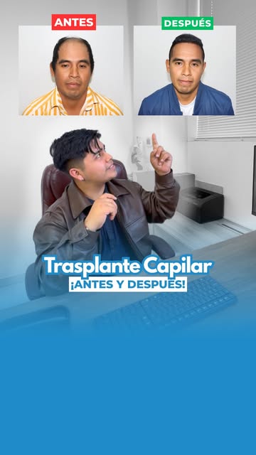 Que increíble RESULTADO! 😱
Separa tu cita ahora al WhatsApp +51 999444231 📲✨