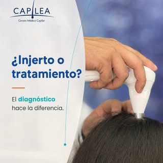 ¿Injerto o tratamiento capilar? La respuesta depende de tu diagnóstico.

No todos los casos de pérdi