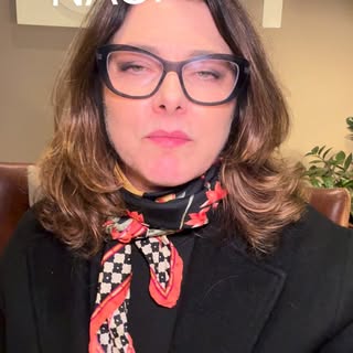 #transplantecapilar #calvicie #tecnicafue #autoestima #cirurgiacapilar