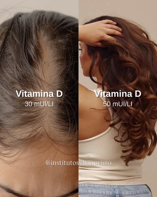 Seu cabelo não cai “do nada”.

Ele pode estar respondendo a deficiências hormonais e alterações inte