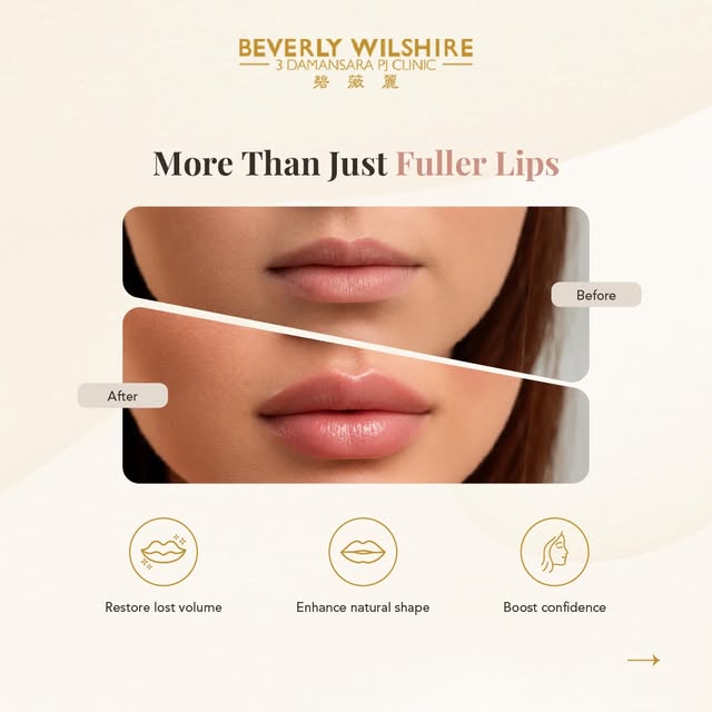 👄Not all lip fillers are about going bigger — the real beauty is in the details.

From restoring lo