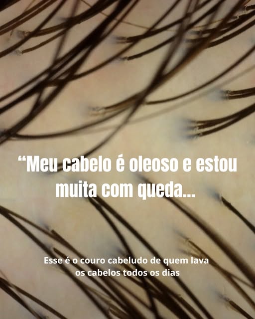 Maior erro que cometemos é; logo que começa uma queda diminuir a frequência de lavagem, o couro cabe