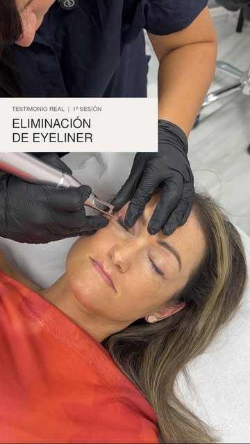 Mira este rabito… parecía antes un perro pachón, con la mirada hacia abajo 😅

Así describió ella el