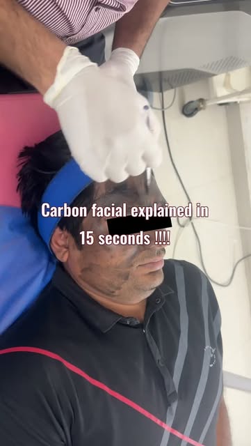 Carbon Facial in 15 seconds? Let’s break it down. ✨

A carbon-based mask is applied to the skin and 