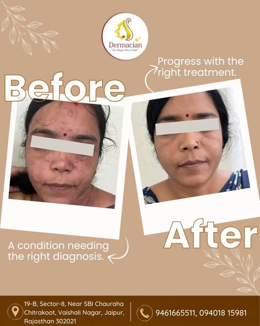 **Every skin concern starts with understanding the cause. ✨**

A condition needing the right diagnos