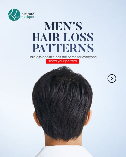 Understand your hair loss pattern to take the right next step. Early assessment can help guide appro