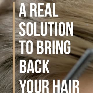 At Hair By Dr. Max, we are attentive to all your hair restoration needs and are happy to offer other