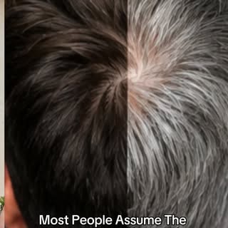 Why does hair turn gray? It may be more complicated than pigment cells simply “dying.”

Emerging res
