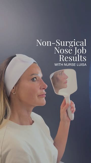 Immediate results. No surgery.

A non-surgical nose job can subtly reshape and rebalance the profile
