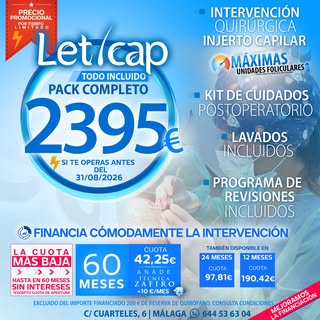 Dejarlo para “después del verano” es seguir perdiendo pelo. El verano es el momento perfecto para da