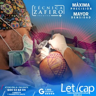 💎 En Leticap apostamos por la técnica FUE Zafiro: la evolución definitiva en el injerto capilar. Es