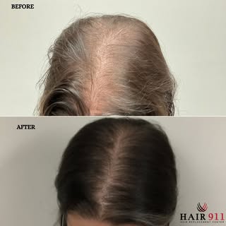💇‍♀️ Did you know?

Over 50% of women will experience noticeable hair loss in their lifetime.
It’s 