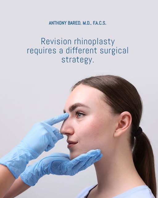 Revision rhinoplasty is not simply a second version of primary rhinoplasty.

Previous surgery can al