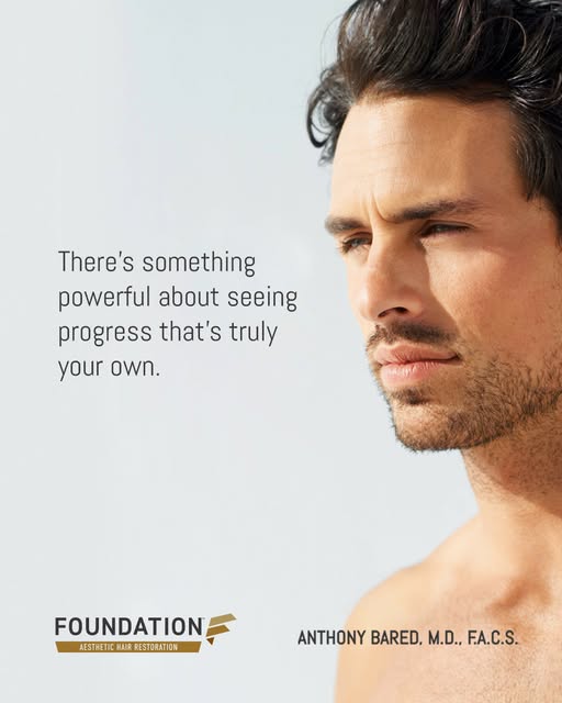 One of the most rewarding aspects of hair restoration is that the transformation comes from your own