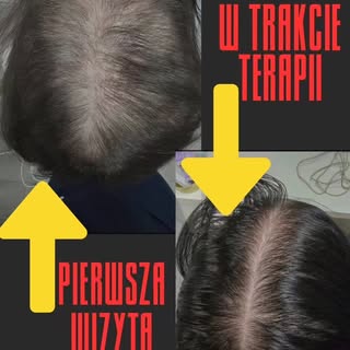Ta historia włosowa nie należy do prostych😟

Na koncie było już kilka epizodów odzyskania nadmierni