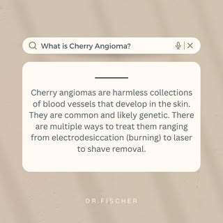 Q&A with Dr. Fischer 🪄

What is a #cherryangioma?!

𝐕𝐢𝐬𝐢𝐭 & 𝐛𝐨𝐨𝐤 𝐰𝐢𝐭𝐡 𝐦𝐞 ⇡ 𝐥𝐢𝐧𝐤 
