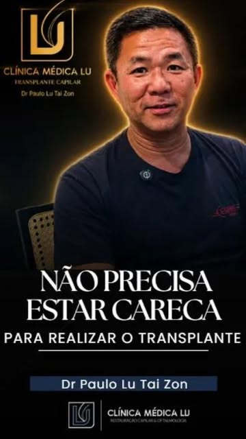 Orientais também podem ter perda de densidade e calvície, e o caso do Sr. Edson mostra exatamente is