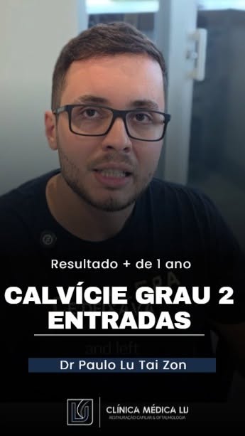 Ele precisava pentear o cabelo de um jeito específico para esconder as entradas. Hoje, 14 meses depo