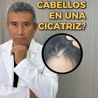 🩸💊 Puede crecer cabellos en una cicatriz✨. 
 Si puede crecer cabellos en la cicatriz pero antes ne