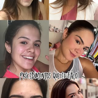 Como prometido, um resumo dos tratamentos que venho fazendo nos últimos anos no meu rosto! Espero qu