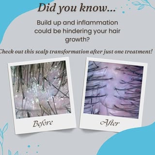 🌿 Did You Know?
Inflammation and scalp buildup may be standing in the way of healthy hair growth. A