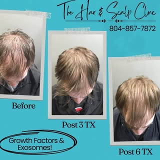 🌱 Small changes today. Remarkable results tomorrow.
Healthy hair doesn’t happen overnight—but with 