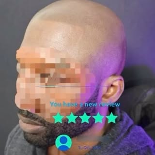Introducing SMP - Your #1 Hair Loss Solution!

🌟 Tired of thinning hair and receding hairlines? Loo