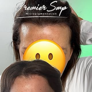 ✨ Ladies, SMP isn’t just for men! ✨

If you’re looking for a soft, subtle solution to thinning hair 