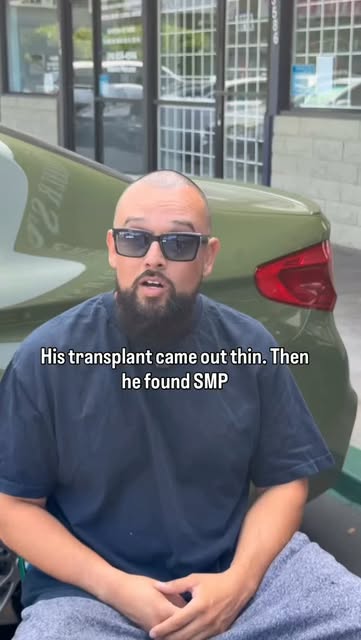 He got a hair transplant. It came out thin. 👀

Alfredo spent thousands hoping for density but a tra