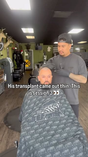 SESSION 3 🔥 Alfredo’s transformation

He came to me with a thin hair transplant. Sessions 1 and 2 b
