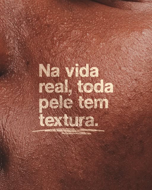 Poros, linhas finas, pequenas irregularidades… tudo isso faz parte de uma pele viva, real.

Tratamen