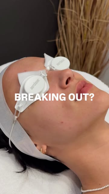 Breaking out doesn’t always mean putting your treatments on pause 👀

Aerolase Neo is a gentle laser