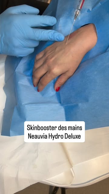 #neauvia #skinboosters #drsaityilmaz #luxembourg #medecineesthetique