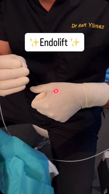#endolift #endoliftingláser #drsaityilmaz #luxembourg #medecineesthetique