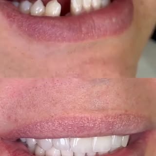 A smile can change more than just your appearance—it can change the way you feel. 

At AKS Aesthetic
