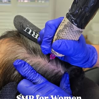 Hair loss in women can be caused by a variety of factors—some temporary, others more permanent. Here