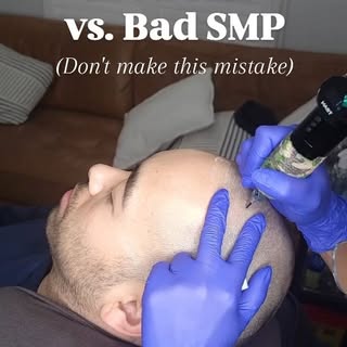 Here's the difference between good SMP & bad SMP.

Bad SMP is usually the result of:
• Going too dar