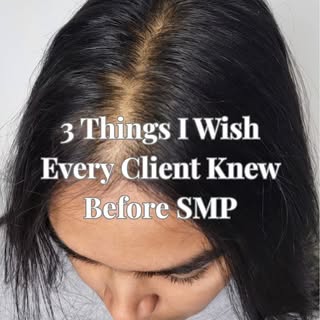 SMP is one of the most natural-looking hair loss solutions...but there are a few things I wish every