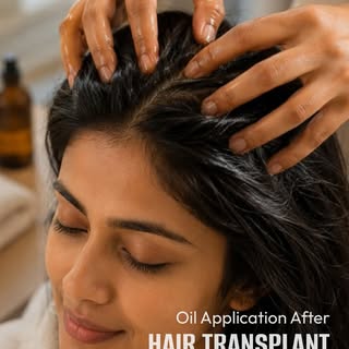 Using oil after a hair transplant can help keep your scalp nourished but timing and technique matter