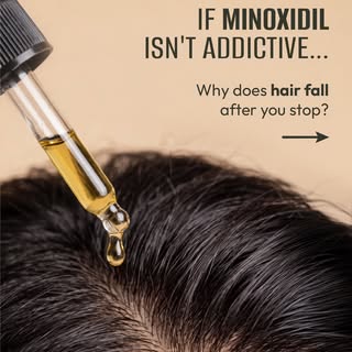 Minoxidil doesn’t create “addiction” it simply helps keep hair in the growth phase while you use it.