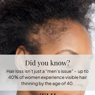 Hormones, stress, genetics, and even tight hairstyles can all play a role. The good news? There are 