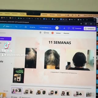 Soy médico tricóloga, especializada en el diagnóstico y tratamiento integral de las enfermedades del