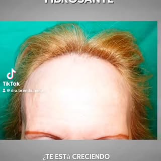 Soy médico tricóloga, especializada en el diagnóstico y tratamiento integral de las enfermedades del