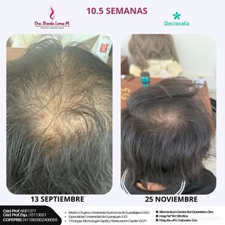 Soy médico tricóloga, especializada en el diagnóstico y tratamiento integral de las enfermedades del